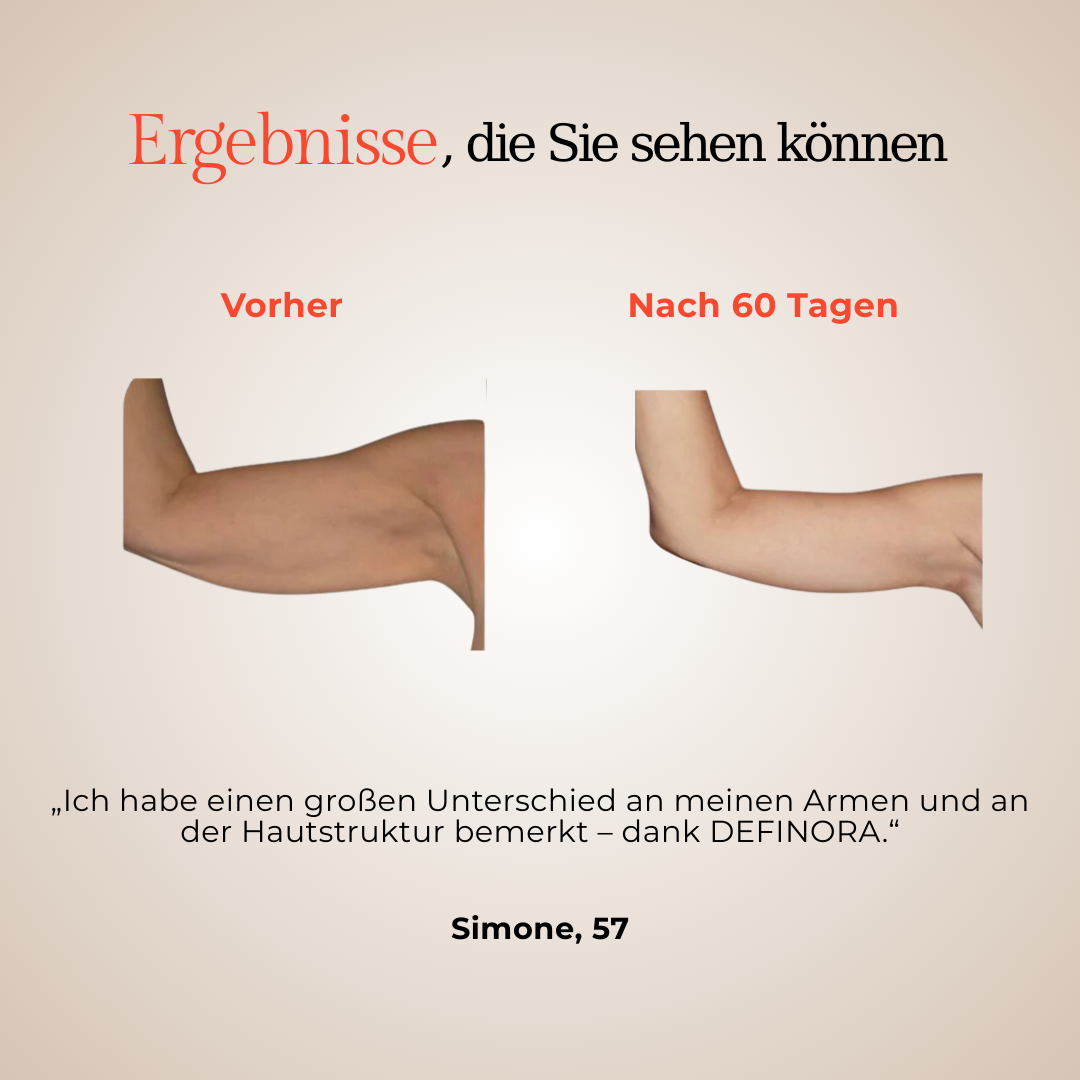 DEFINORA™ Arm | Dual-Wellenlängen Rotlicht-Armwrap mit 3-Lagen-Lift-Technologie™