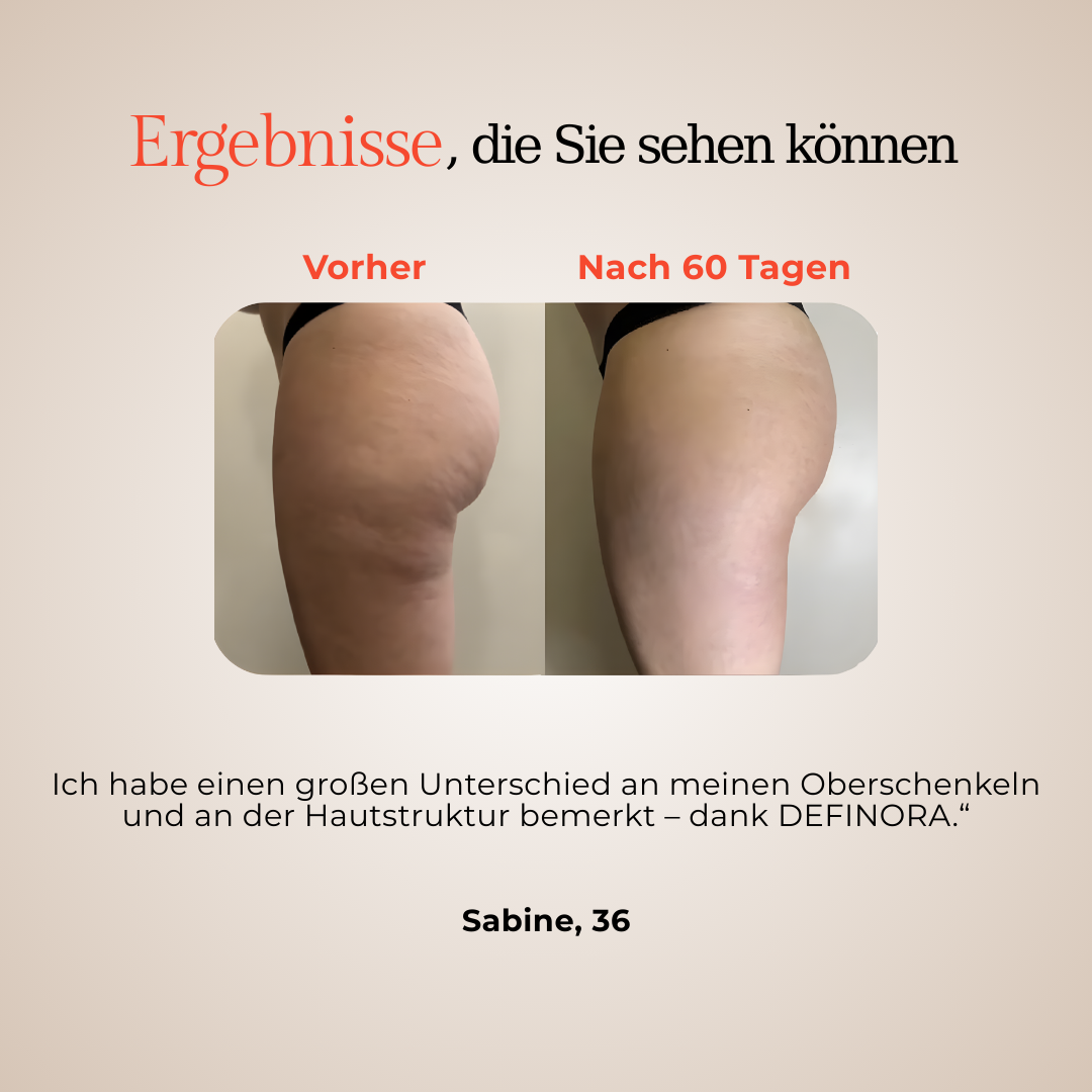 DEFINORA™ Thigh | Dual-Wellenlängen Rotlicht-Beinwrap mit 3-Lagen-Lift-Technologie™