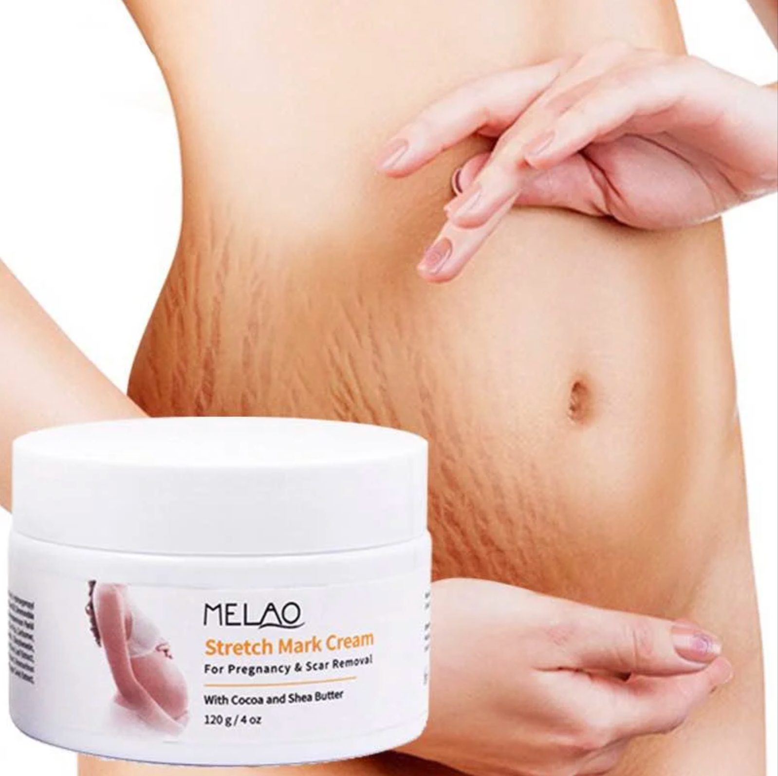 Definora X Melao™ Stretch Mark Cream